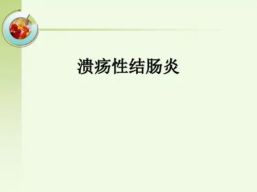 溃疡性结肠炎PPT课件