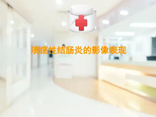 消化系统—溃疡性结肠炎的影像表现(医学影像诊断学课件)