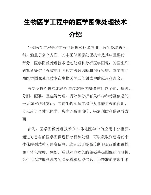 生物医学工程中的医学图像处理技术介绍