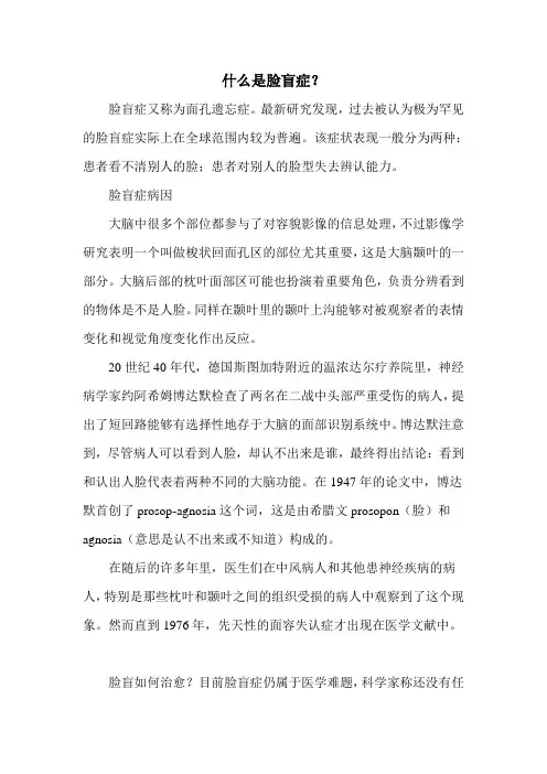 什么是脸盲症？