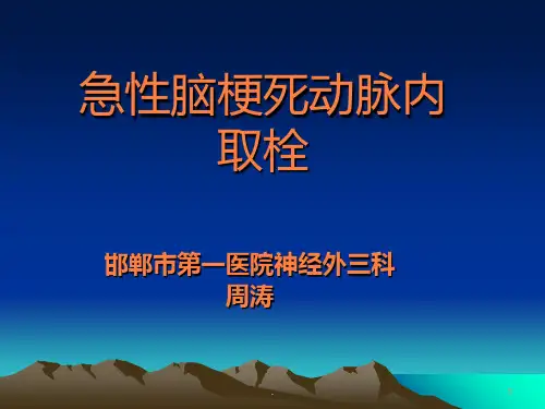 急性脑梗机械取栓ppt课件
