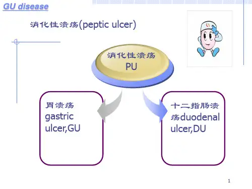 胃十二指肠溃疡PPT课件