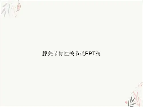 膝关节骨性关节炎精PPT.