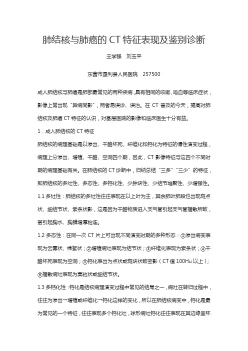 肺结核与肺癌的CT特征表现及鉴别诊断