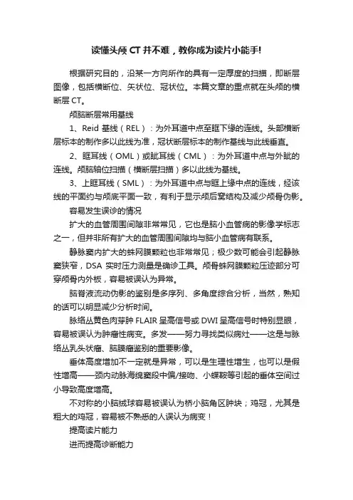 读懂头颅CT并不难，教你成为读片小能手!