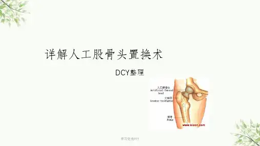 详解人工股骨头置换术课件