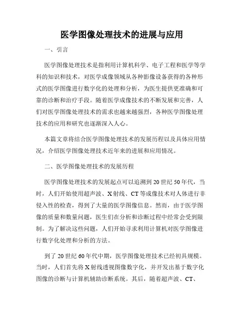 医学图像处理技术的进展与应用
