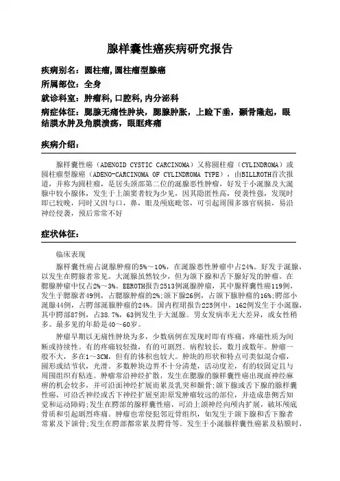 腺样囊性癌疾病研究报告