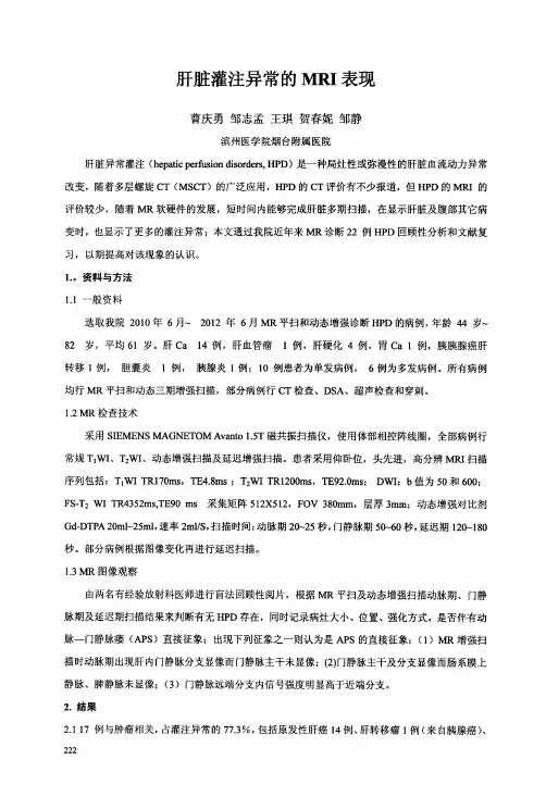 肝脏灌注异常的MRI表现