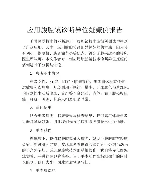 应用腹腔镜诊断异位妊娠例报告