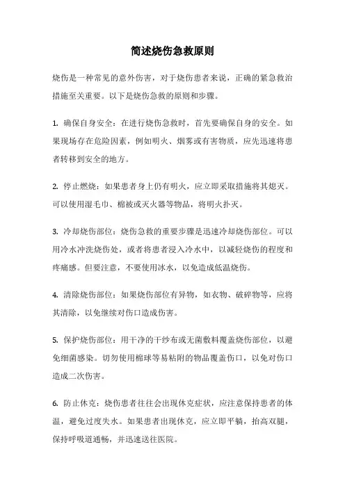 简述烧伤急救原则