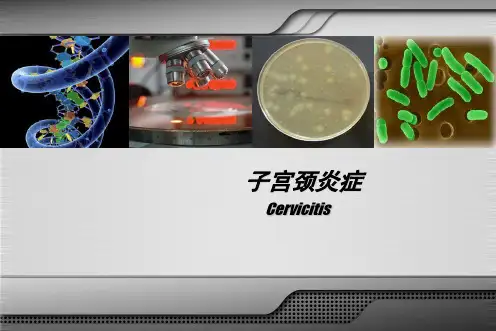 子宫颈炎症ppt课件