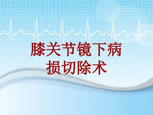 手术讲解模板：膝关节镜下病损切除术