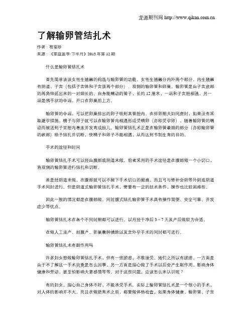 了解输卵管结扎术