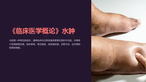 《临床医学概论》水肿