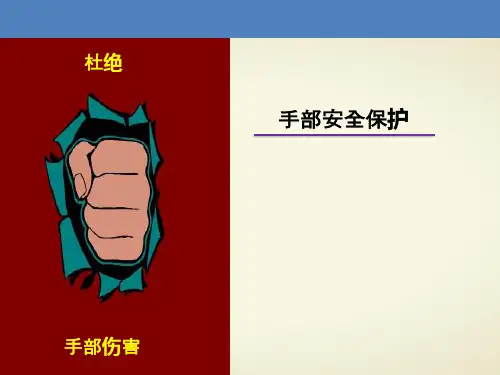 手部安全保护(安全生产培训)