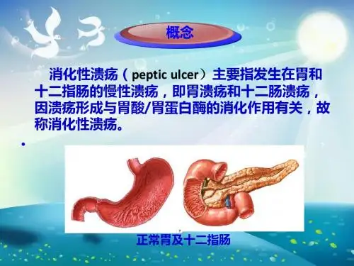 消化系统 消化性溃疡护理业务学习课件