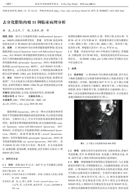 去分化脂肪肉瘤11例临床病理分析