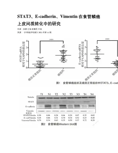 STAT3、E-cadherin、Vimentin在食管鳞癌上皮间质转化中的研究