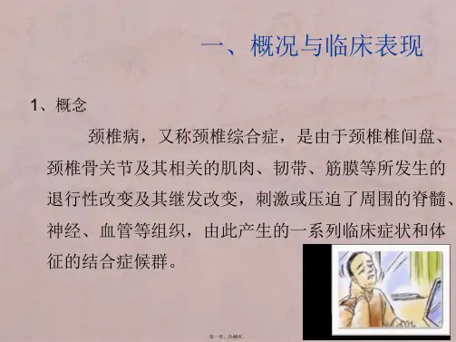 颈椎病(精)