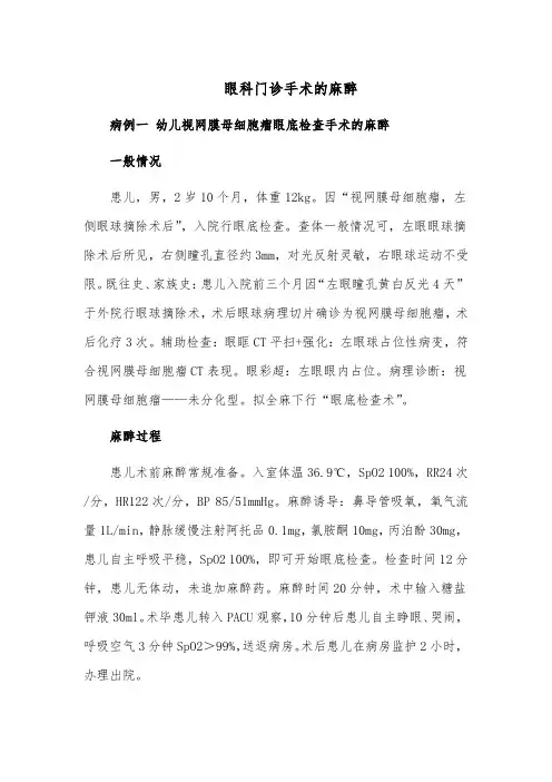 眼科门诊手术的麻醉