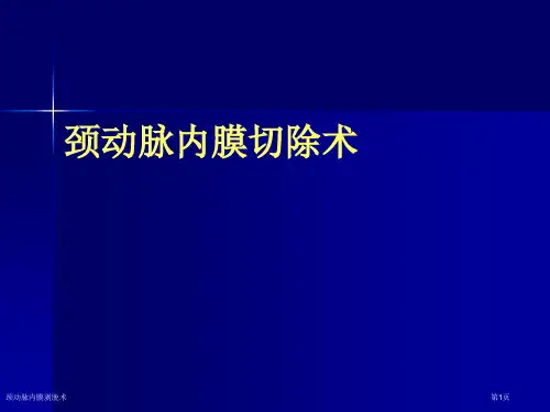 颈动脉内膜剥脱术ppt课件