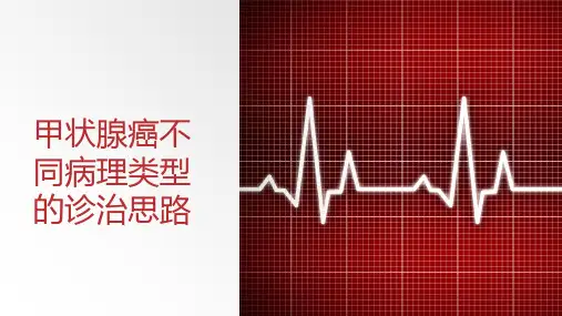 甲状腺癌不同病理类型的诊治思路