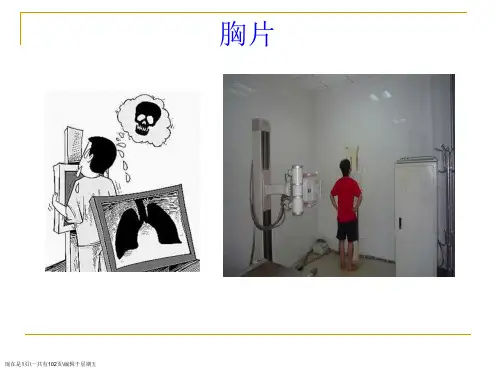 呼吸科影像学带教(X线、CT,全,够用)