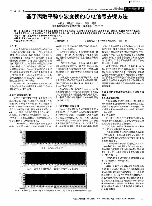基于离散平稳小波变换的心电信号去噪方法