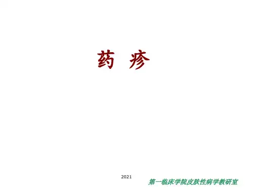 药物性皮炎(药疹)PPT课件