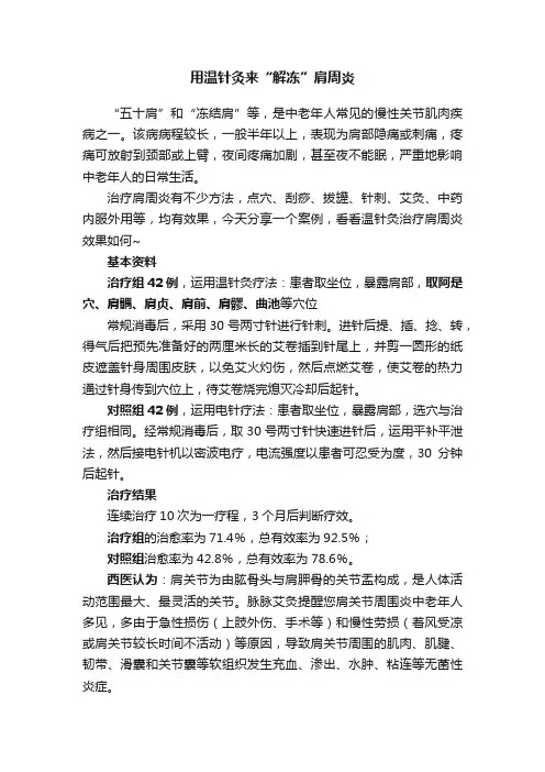 用温针灸来“解冻”肩周炎