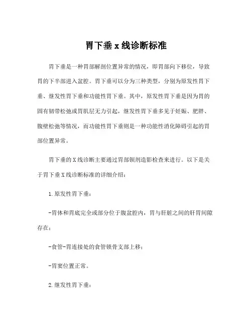 胃下垂x线诊断标准