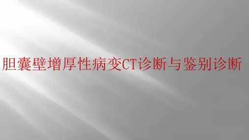 胆囊壁增厚性病变CT诊断与鉴别诊断