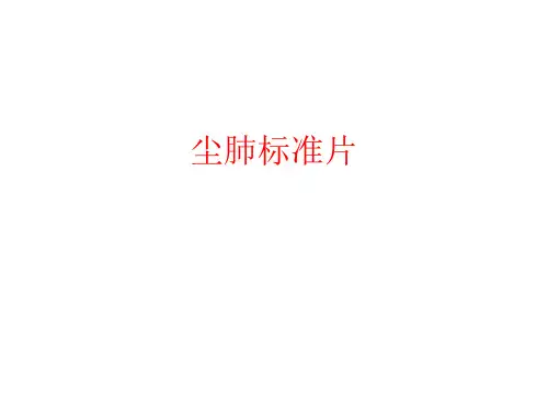 尘肺标准片 ppt课件