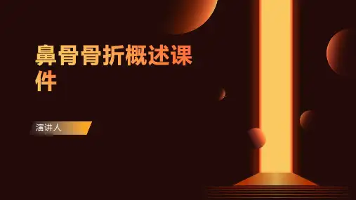 鼻骨骨折概述课件