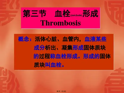 4.血栓形成-PPT课件(共19张)