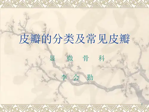 皮瓣种类ppt课件