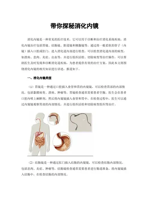 带你探秘消化内镜