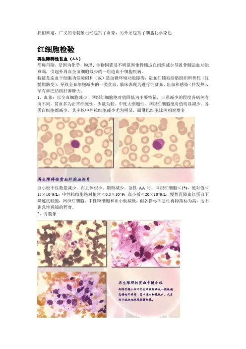 专业实验III 常见血液学疾病的血象、骨髓象