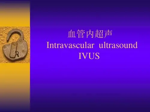 血管内超声 I V U S的相关资料ppt课件