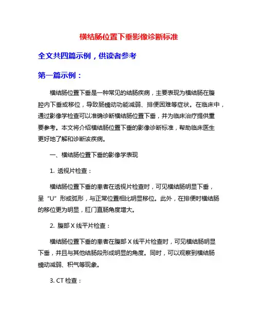 横结肠位置下垂影像诊断标准