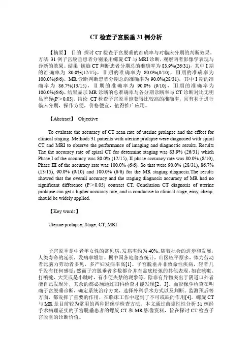 CT检查子宫脱垂31例分析