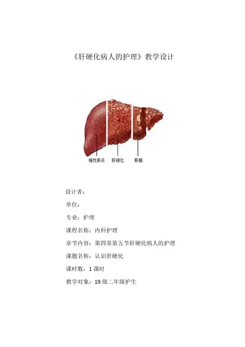 肝硬化病人的护理教学设计方案