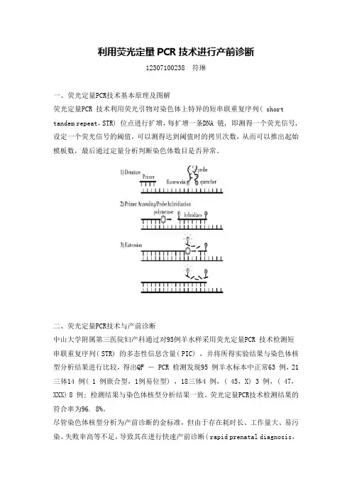 利用荧光定量PCR 技术进行产前诊断