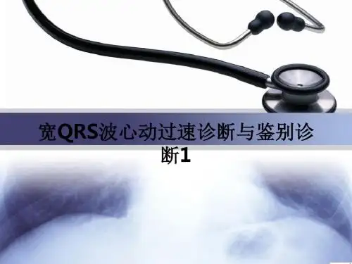 宽QRS波心动过速诊断与鉴别诊断1PPT课件