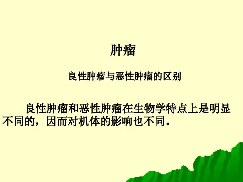 良性肿瘤与恶性肿瘤的区别PPT课件
