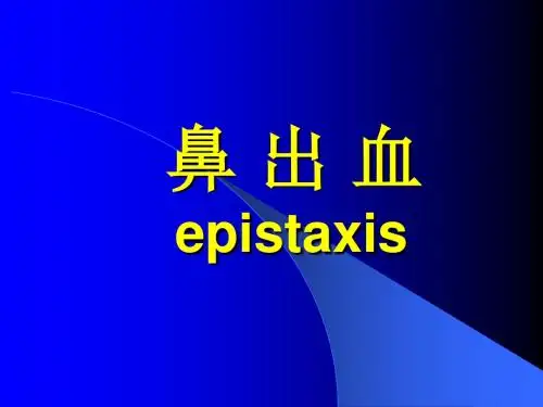 最新鼻出血 PPT课件-药学医学精品资料
