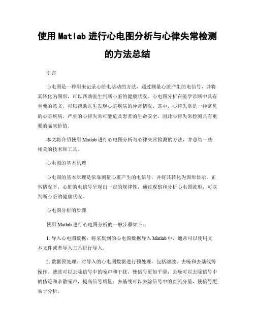 使用Matlab进行心电图分析与心律失常检测的方法总结