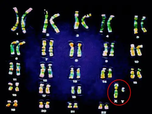 人教版教学课件生物：23《伴性遗传》精品课件(新人教版必修2)(共29张PPT)