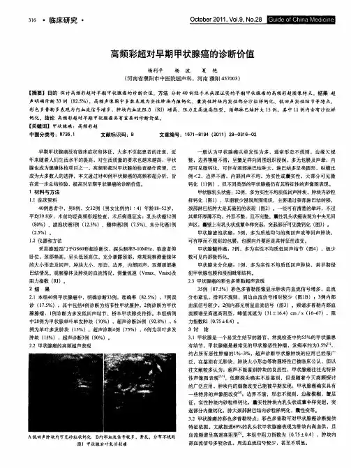 高频彩超对早期甲状腺癌的诊断价值